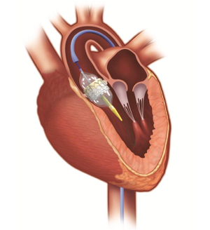 tavr-heart-anatomy-lg